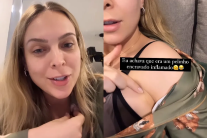 Youtuber Tata Estaniecki diz ter 'terceiro mamilo' na axila: entenda o que é a polimastia - Foto: Reprodução/Instagram