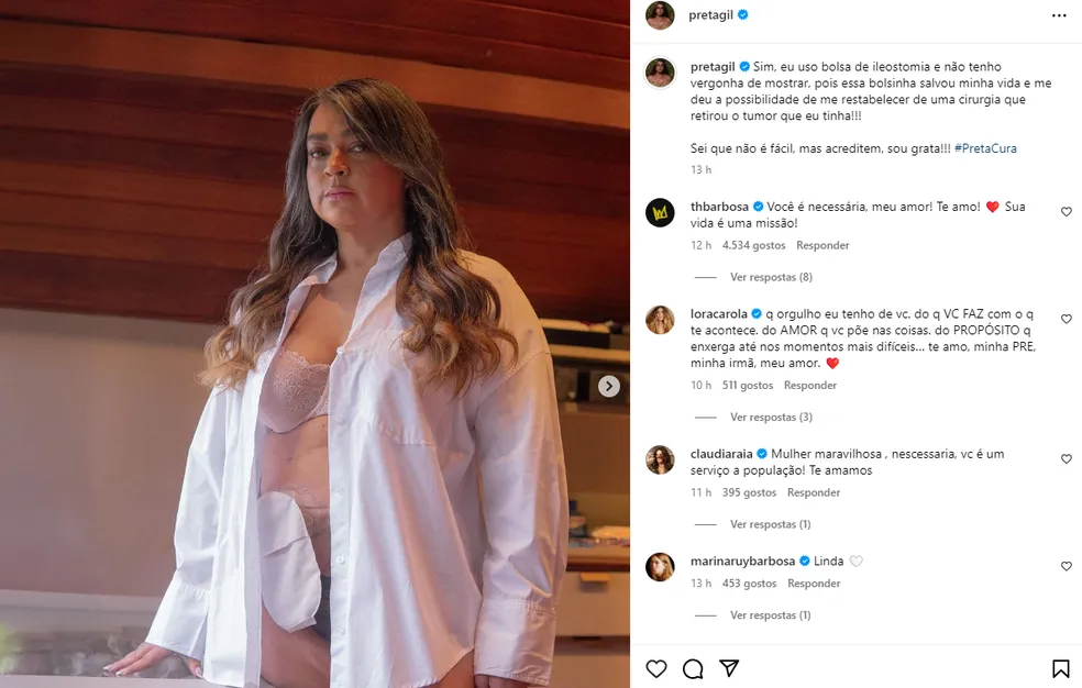 Preta Gil posta fotos com bolsa de ileostomia — Foto: Reprodução/Instagram